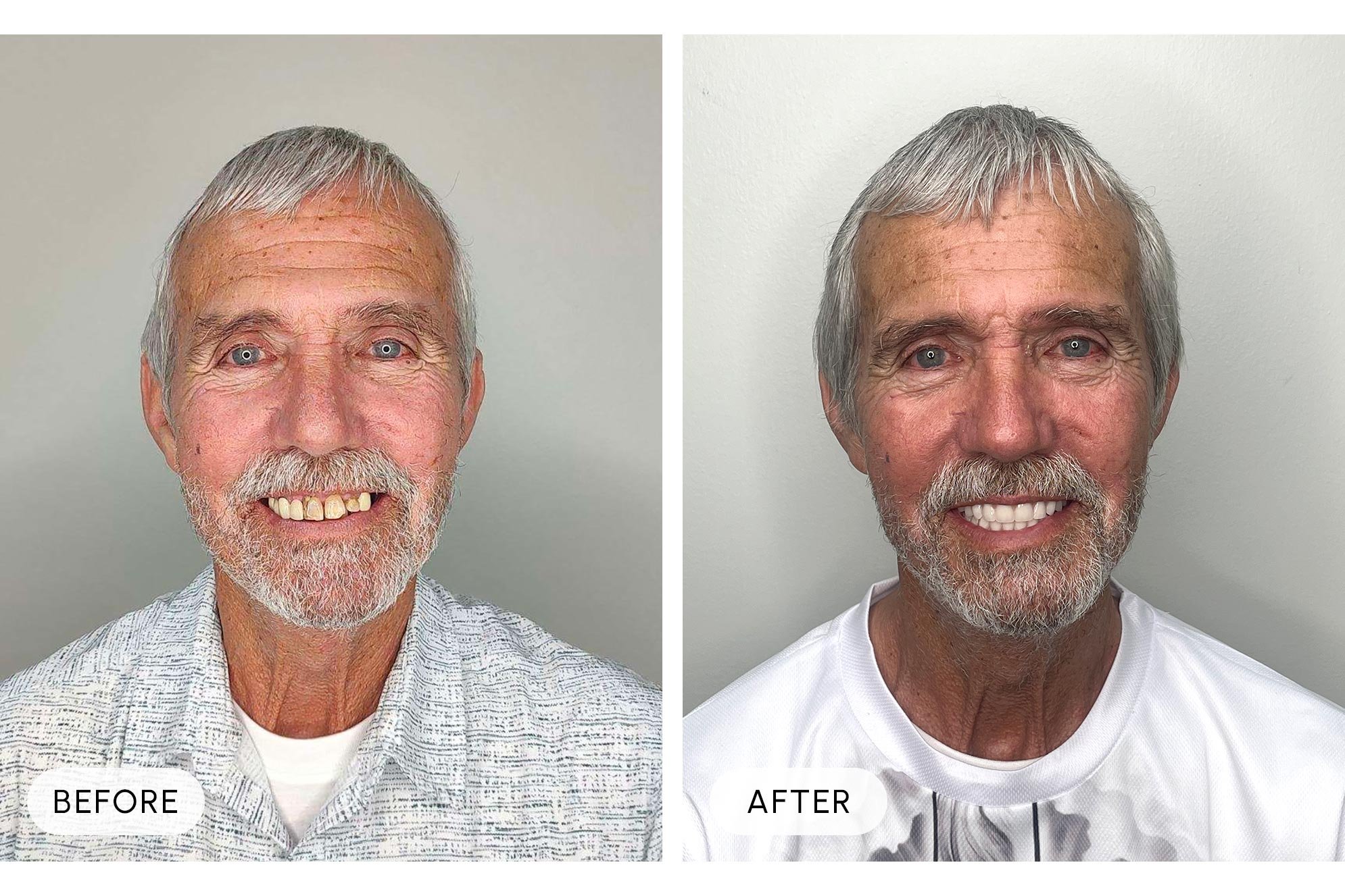 Side-by-side comparison of a senior man before and after a haircut and grooming, smiling with visible teeth, wearing a light-colored shirt in the first image and a white shirt in the second.